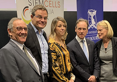 $150 million Federal Government donation to Stem Cells Australia